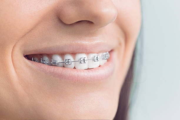 Best Teeth Whitening  in Dakota Ridge, CO